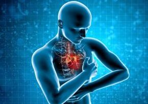 douleur entre les omoplates irradiant latéralement